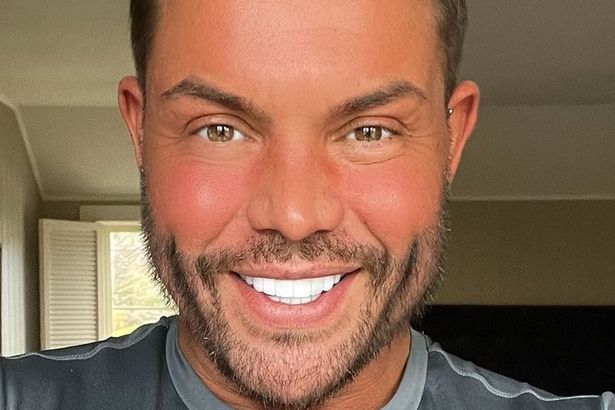 Звезда «Towie» Бобби Норрис предупредил об опасности филлеров после неудачного опыта
